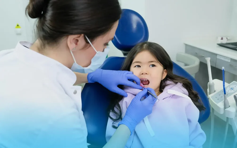 allineamento dentale dopo la caduta dei denti da latte