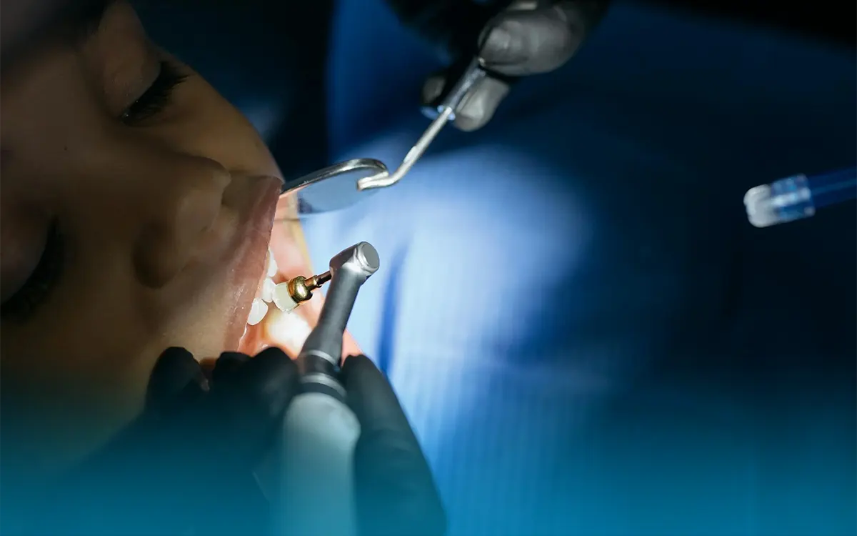 mascella piccola e posizione dei denti