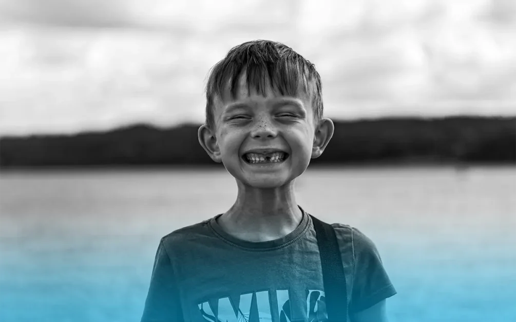 posizione dei denti da latte sorriso futuro