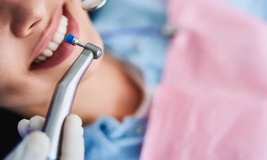 effetti dello zucchero sui denti degli adolescenti