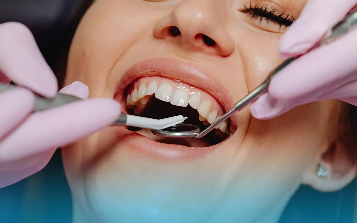 dieta preistorica e allineamento dentale