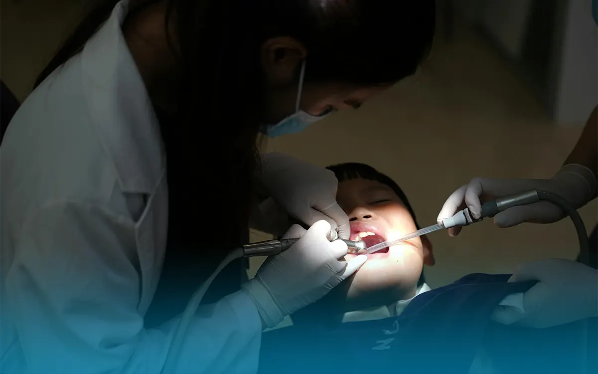 denti di squalo nei bambini
