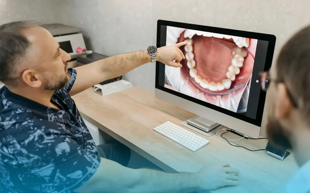 fattori ormonali e allineamento dentale