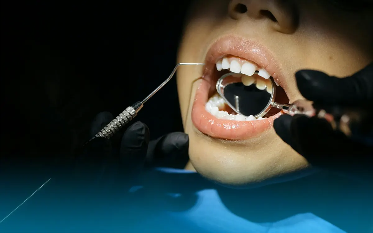 colpo nei denti da latte e nei denti permanenti