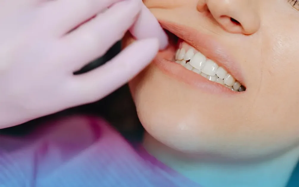 mordere e abitudini per nascondere il sorriso