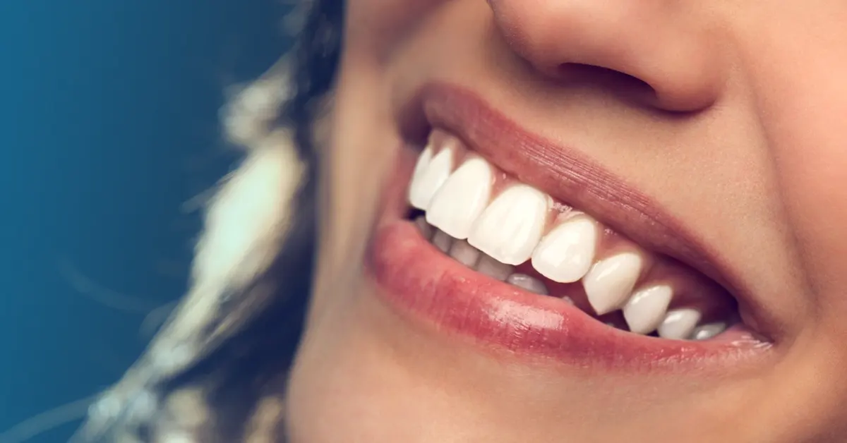 5 abitudini dentali che evito (e che anche tu dovresti evitare)