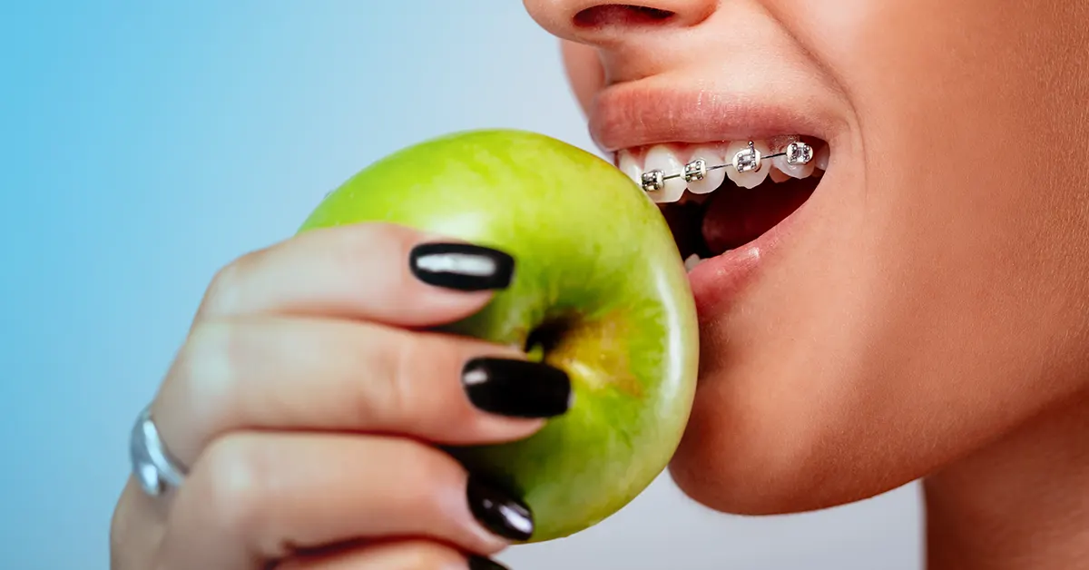 alimenti che riducono la placca dentale
