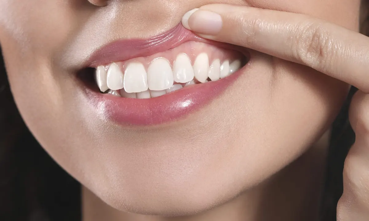 PROBLEMI E TRATTAMENTI GENGIVALI: GUIDA COMPLETA PER UNA SALUTE ORALE PERFETTA