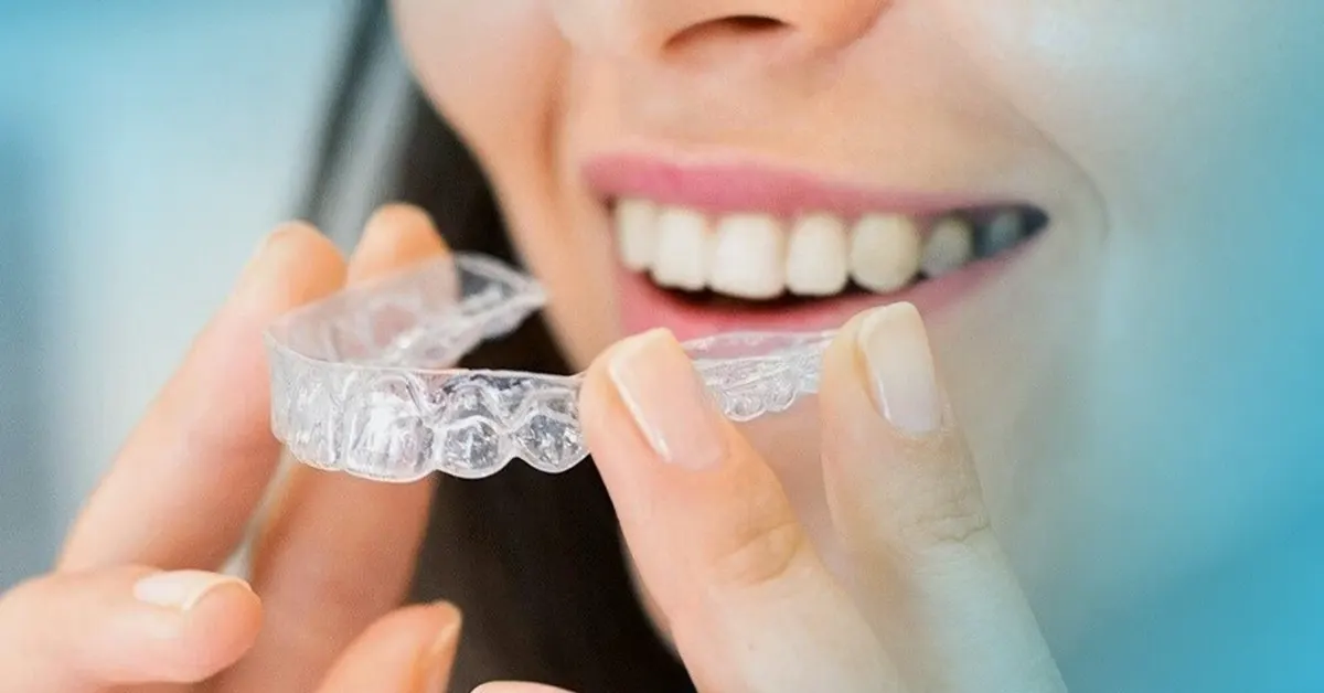 Invisalign o Apparecchio Tradizionale? La mia esperienza diretta ti svelerà la verità che nessuno dice