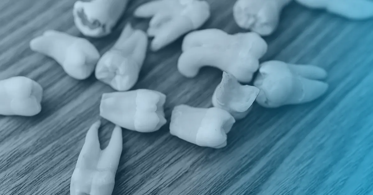dieta per prevenire le carie dentali